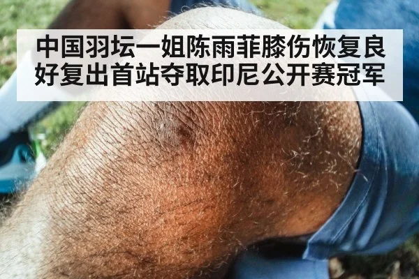 中国羽坛一姐陈雨菲膝伤恢复良好复出首站夺取印尼公开赛冠军